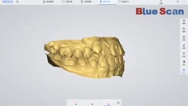 Panda Scanner Orthodontics - 2 смотреть онлайн