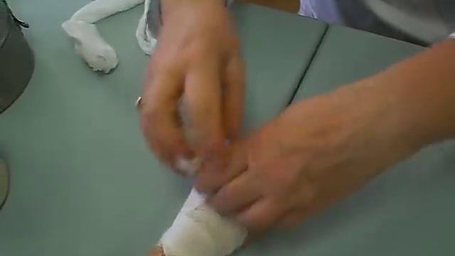 колосовидная на большой палец руки смотреть онлайн