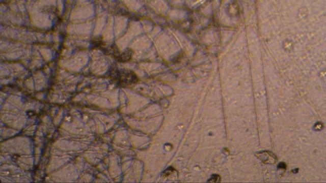 Seilwurm плюс Оспамокс (антибиотик)