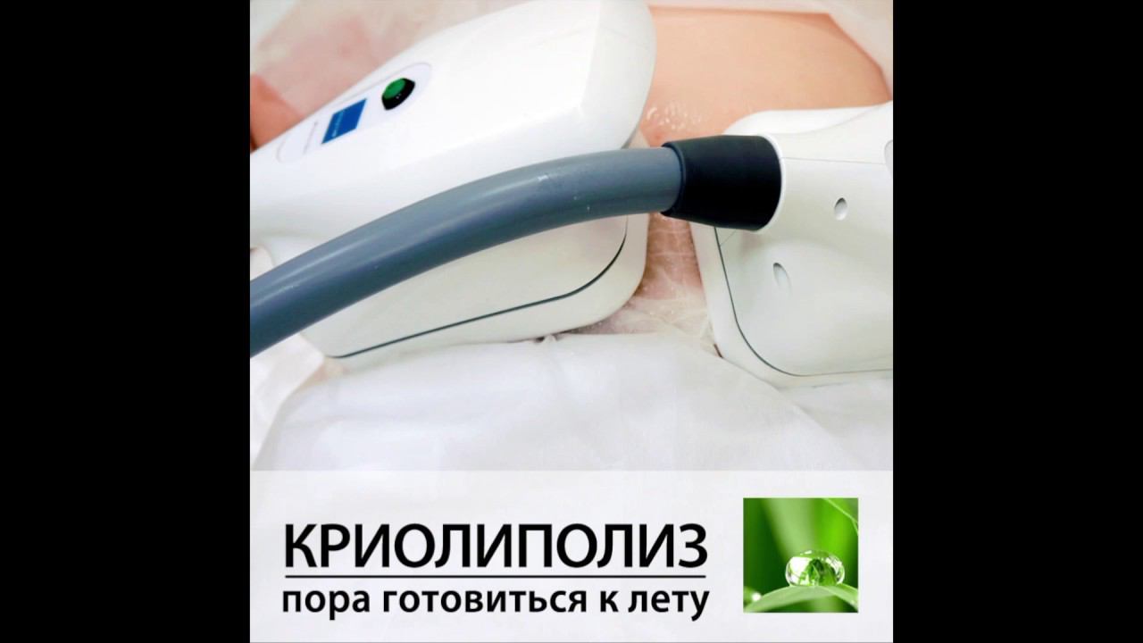 КРИОЛИПОЛИЗ - коррекция жировых отложений и целлюлита за 1 сеанс смотреть онлайн