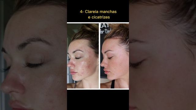 Renove a beleza da sua pele e recupere sua auto estima! смотреть онлайн