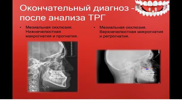 12:00 ДЕТСКАЯ СТОМАТОЛОГИЯ. лекция 6 смотреть онлайн