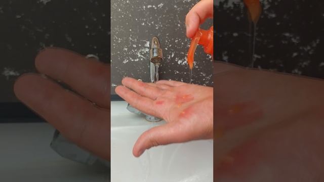 Как избавиться от ожога борщевика. Последствия ожога. смотреть онлайн
