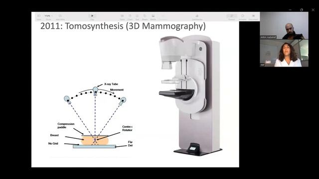 Training QUSTom: Imaging diagnosis in breast cancer: present and future смотреть онлайн