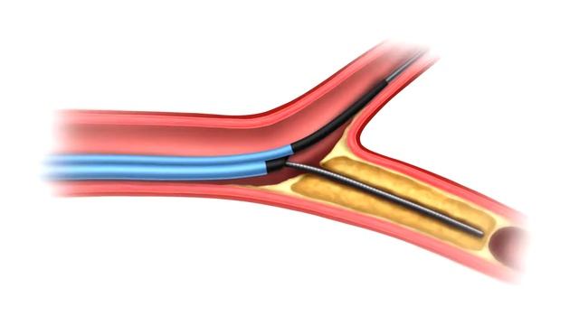 Nhancer Rx Animation смотреть онлайн