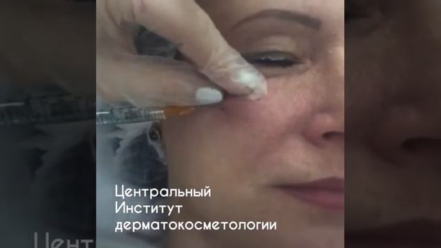 КОРРЕКЦИЯ СКУЛ В ЦИДК