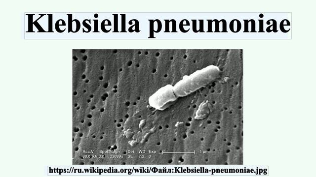 Klebsiella Pneumoniae