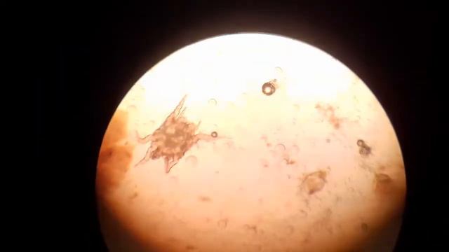 Ушной клещ - (отодектоз) под микроскопом. смотреть онлайн