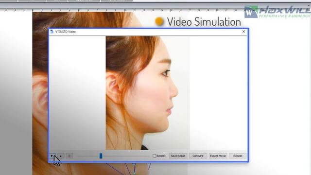 WillCeph- Automated Cephalometric Analysis Software смотреть онлайн