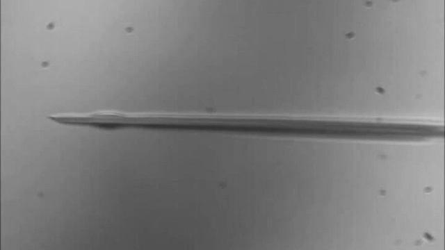 ПИКСИ (pICSI): полный цикл