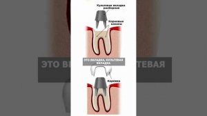 Как сохранить зуб после скола? #зубы #стоматолог #удаление