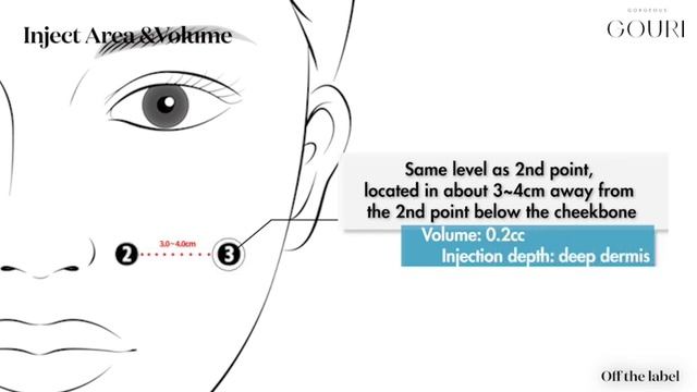 100% liquid type PCL GOURI, premium collagen stimulator - Mediwith Inc. from Korea смотреть онлайн