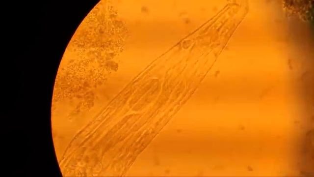 Protozoa feeding in sewerage смотреть онлайн