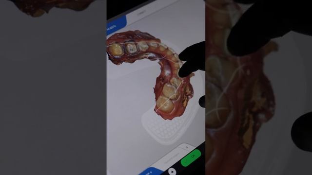 3D сканер. Preview. Цифровая стоматология Gordienko Clinic смотреть онлайн