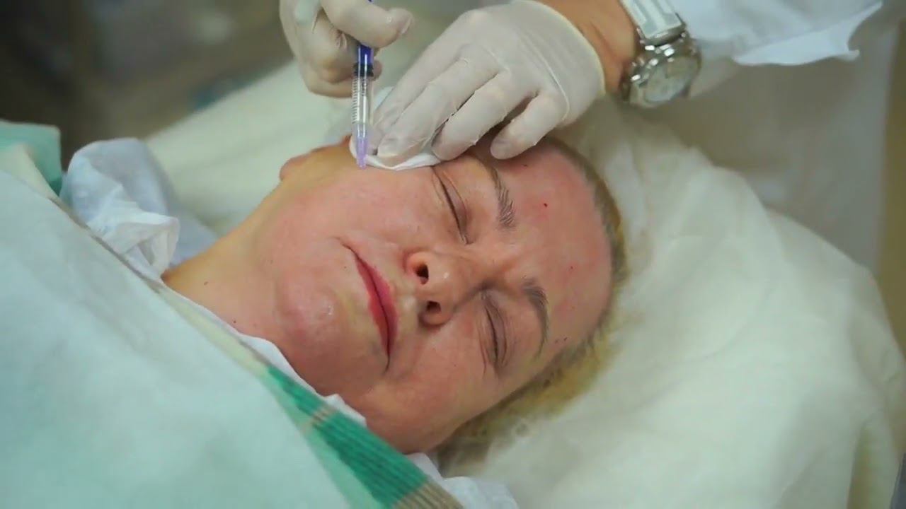 Коллагенотерапия препаратом Linerase смотреть онлайн