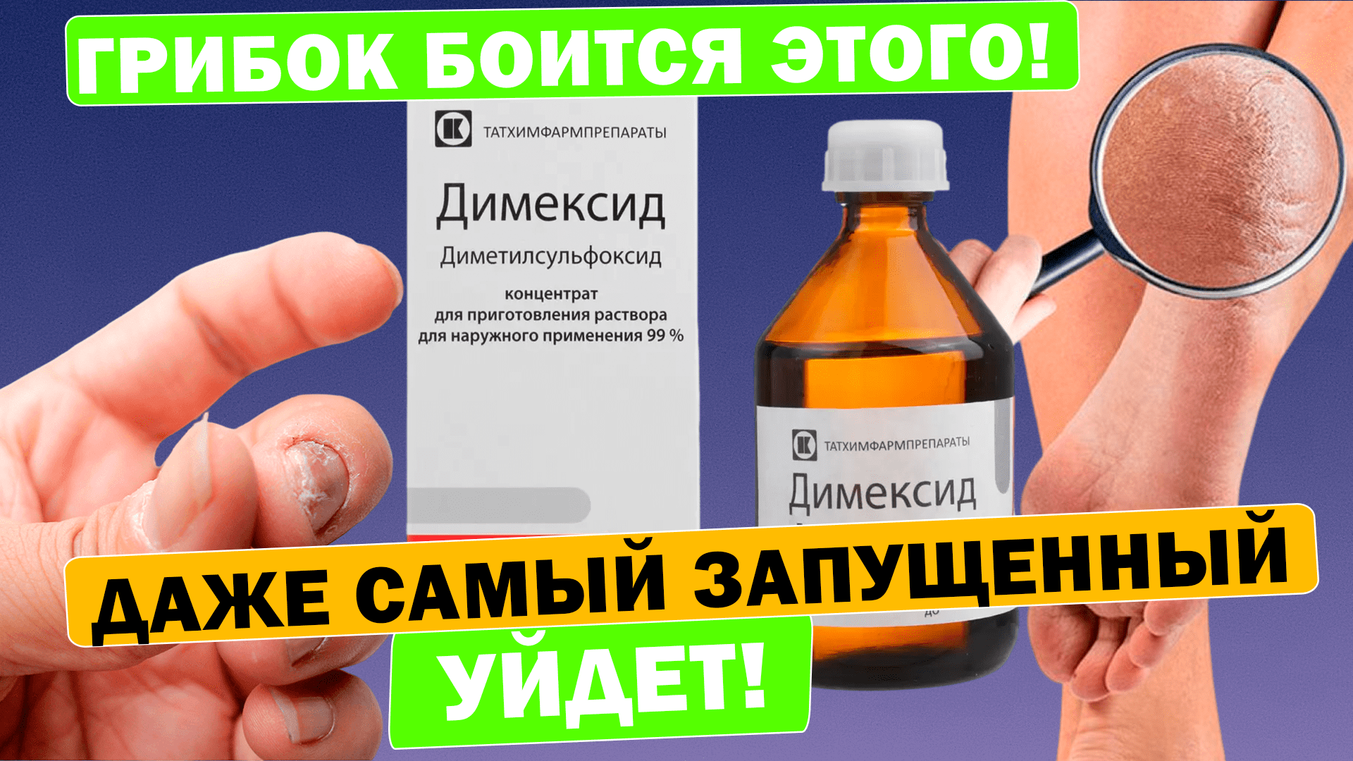 Димексид от грибка спас и ноги вылечил! #димексид смотреть онлайн
