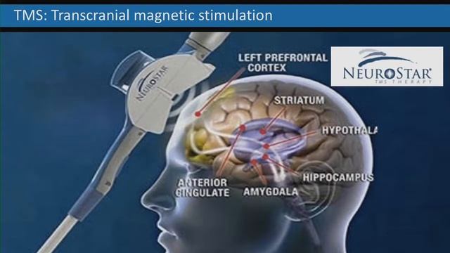 DIVYA CHANDER - Future of Neuroscience - Exponential Medicine 2016 смотреть онлайн