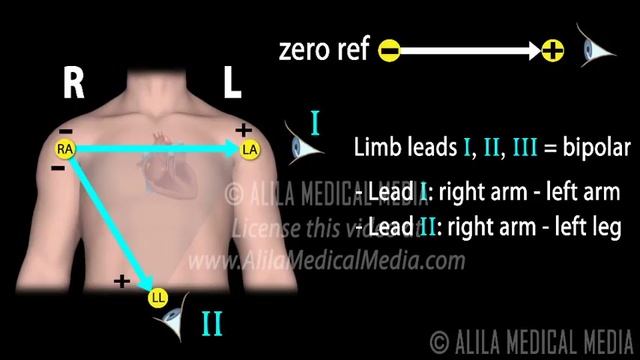 12 Lead ECG Explained, Animation смотреть онлайн