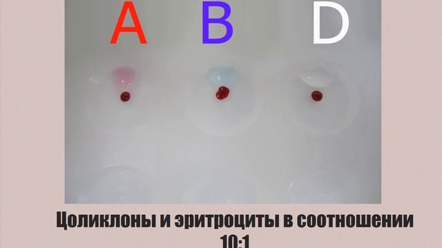 Определение группы крови цоликлонами-1. смотреть онлайн