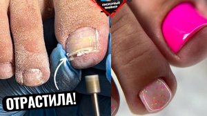 2 МЕСЯЦА ПЕДИКЮРУ! ОЧЕНЬ ДЛИННЫЕ НОГТИ и СНОВА ПОДНОГТЕВАЯ МОЗОЛЬ?