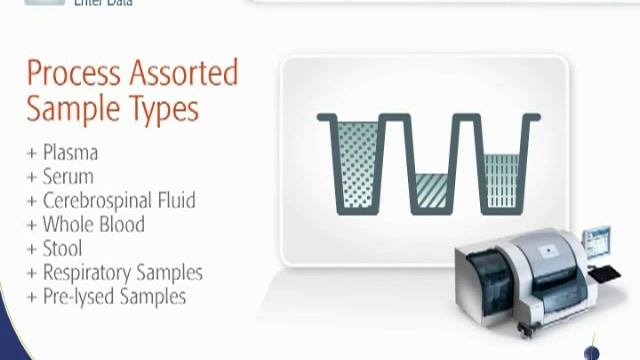 NucliSENS® easyMAG® the most flexible nucleic acid extraction system (bioMérieux, Inc.) смотреть онлайн