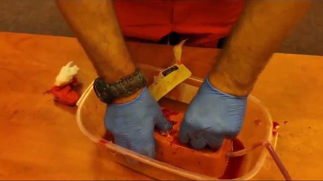 Как правильно тампонировать Z—бинтом смотреть онлайн