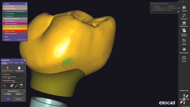 Exocad Anatomic crown + Screw retained I Tooth Modeling 6 смотреть онлайн