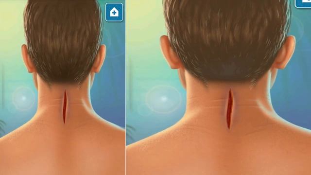► Brain Surgery Simulator Tornado Crisis - Tabtale Brain Surgery Doctor Games For Kids become docto смотреть онлайн