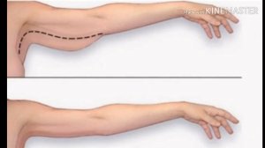 Упражнение Оса избавит от обвисшей кожи и складок на руках