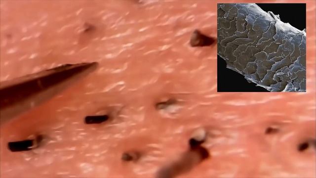 Девушка первый раз на эпиляции. Удаление вросших волос. Волосы под микроскопом #волосы #станок смотреть онлайн