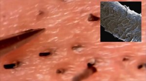 Девушка первый раз на эпиляции. Удаление вросших волос. Волосы под микроскопом #волосы  #станок