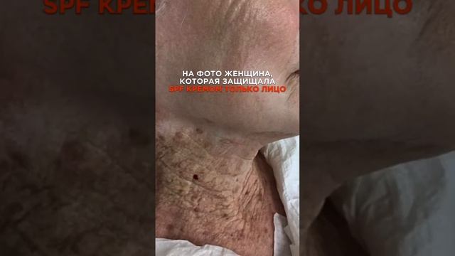 spf (спф) защита от солнца, крем spf (спф крем) - важность нанесения не только на лицо, но и на шею смотреть онлайн