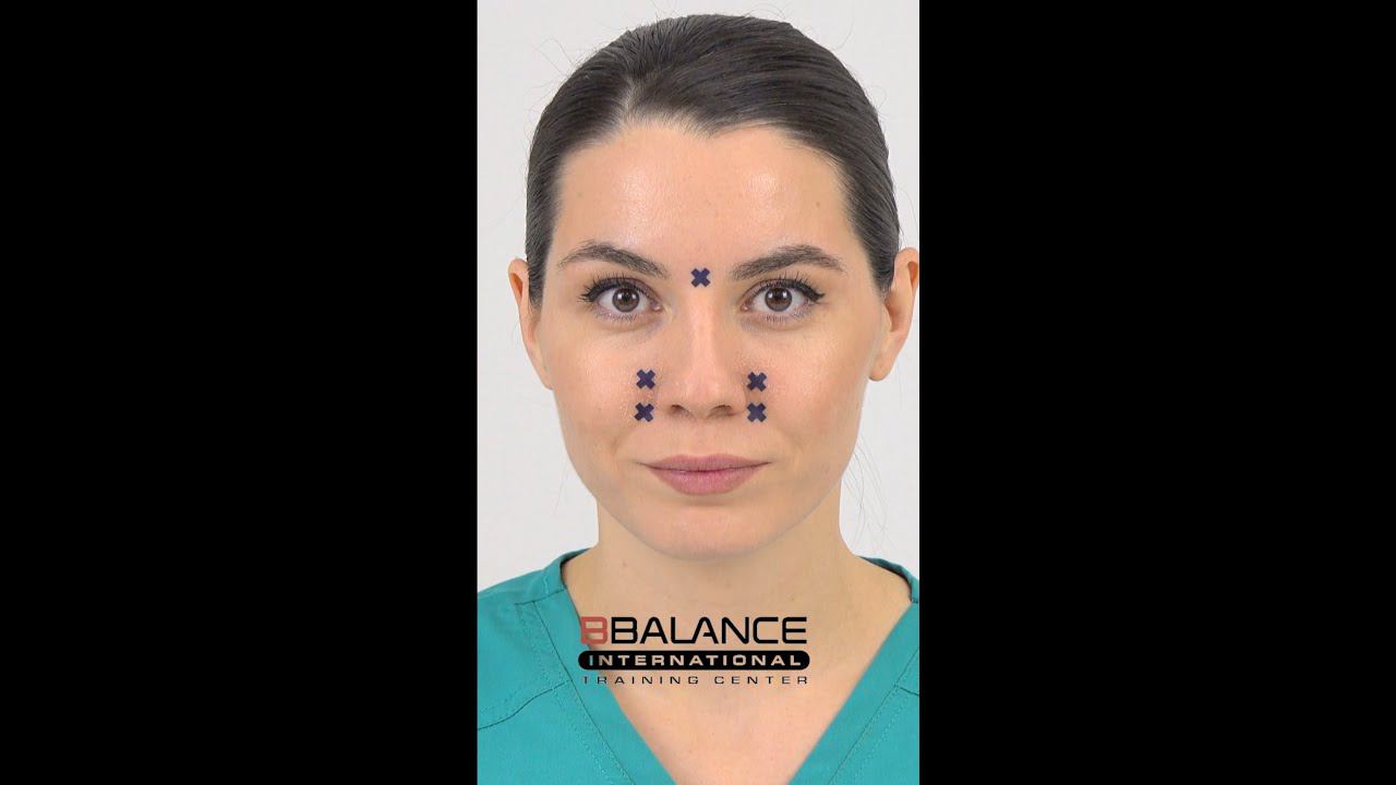 ЛЕЧЕНИЕ НАСМОРКА С ПОМОЩЬЮ АКУ ТЕЙПОВ смотреть онлайн