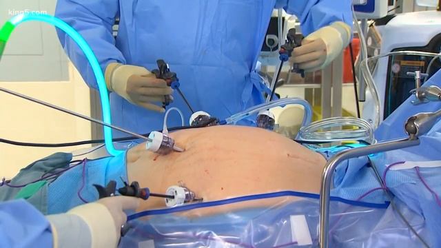Gastric bypass surgery: the procedure смотреть онлайн