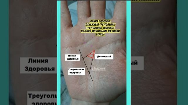 Разница между треугольником здоровья и денежным треугольником смотреть онлайн
