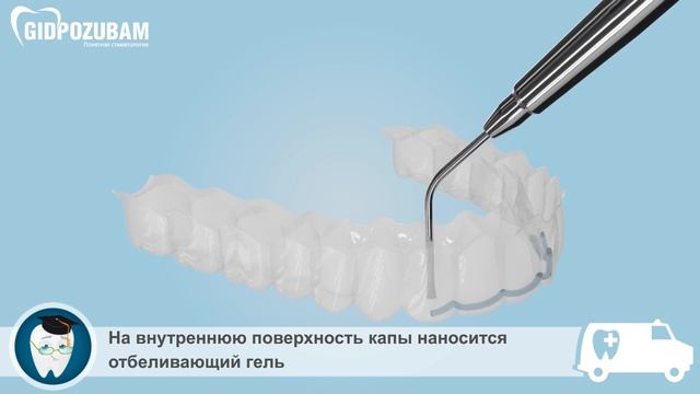 Отбеливание зубов. Домашнее отбеливание капами смотреть онлайн