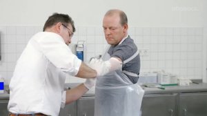 Снятие слепка при изготовлении протеза предплечья. Для специалистов по протезированию рук