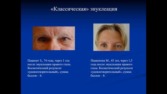 Общество онкологов ГБУЗ «ЧОКЦОиЯМ» 20.01.2021