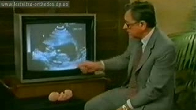 Аборт. смотреть онлайн