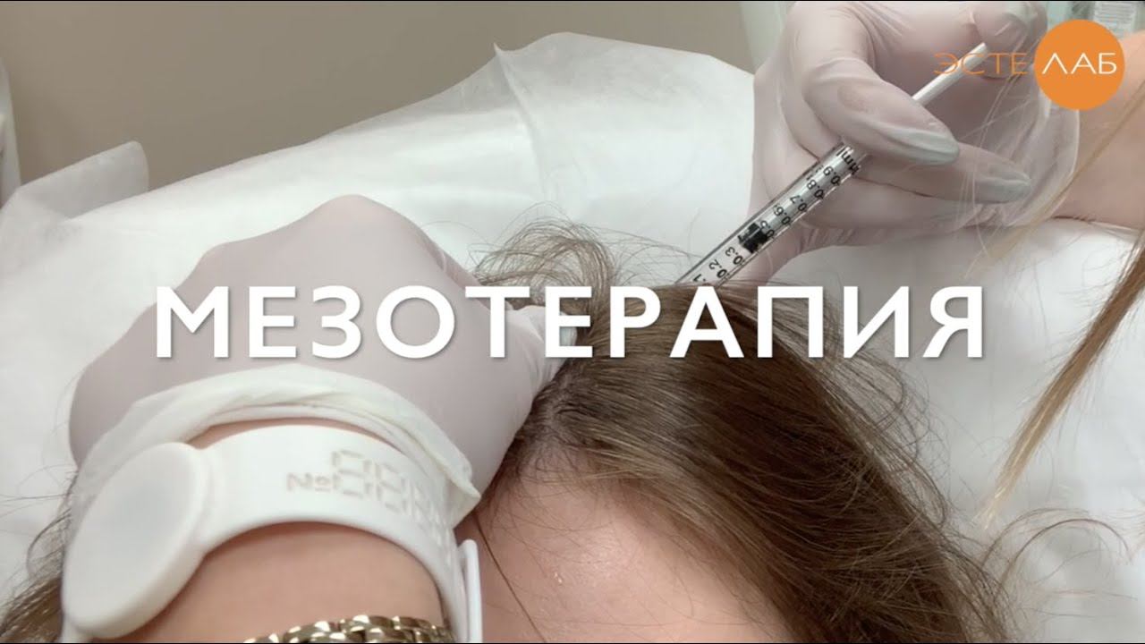 Мезотерапия лечение выпадения волос смотреть онлайн