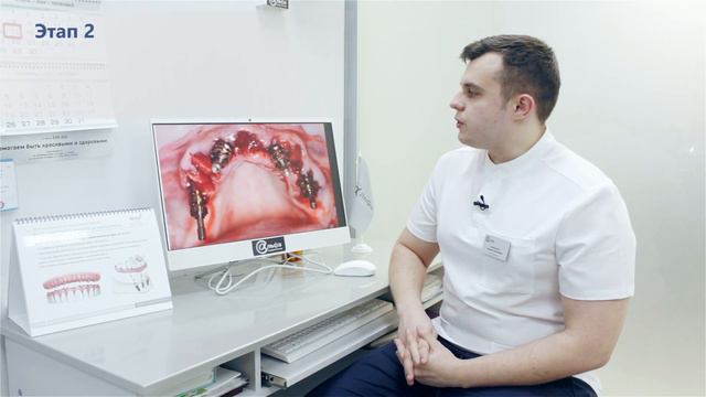Тотальное протезирование на 4х имплантатах смотреть онлайн