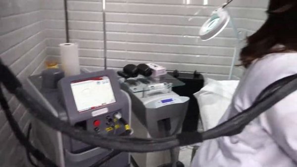 Candela Gentle Lase Pro U guarantees a delicate approach and an excellent result of the procedure.