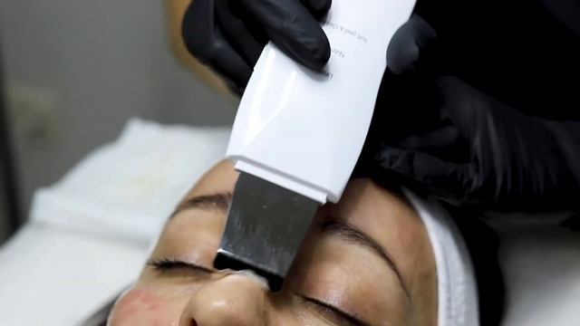 Ультразвуковая чистка лица смотреть онлайн