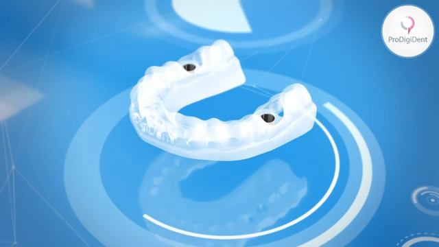 Хирургические шаблоны ProDigiDent смотреть онлайн