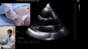 Подготовка к сдаче аккредитационного экзамена УЗД, ФД (к.м.н., Кирсанов Р.И.)