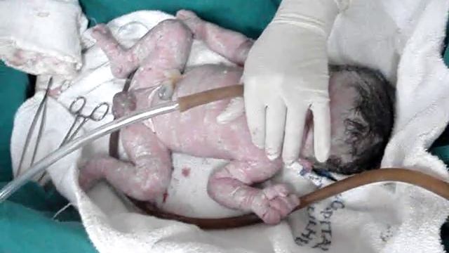 MATHEUS AUGUSTO NAVES MONTEIRO E GUILHERME NAVES MONTEIRO 23