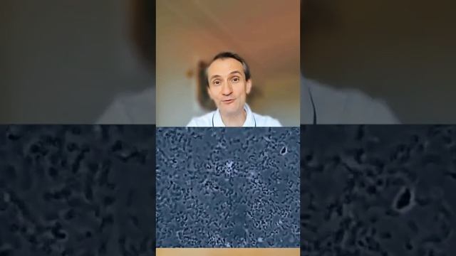 аллергия у детей как избавиться как укрепить иммунитет псориаз нейродермит смотреть онлайн