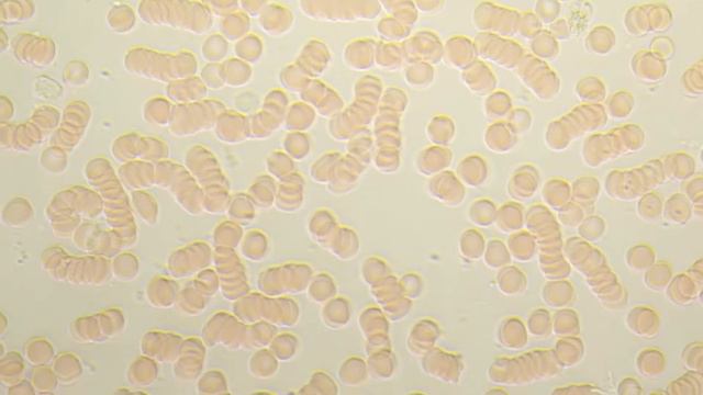 Состояние крови после употребления растительного сыра по собственной технологии смотреть онлайн