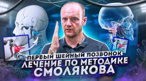 ? Причина 1001 болезни! Лечение первого шейного позвонка Атланта