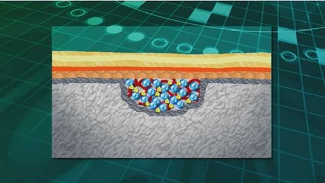 Регенерация кости смотреть онлайн